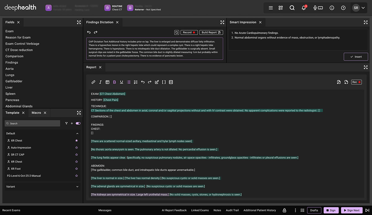 AI-Native Reporting