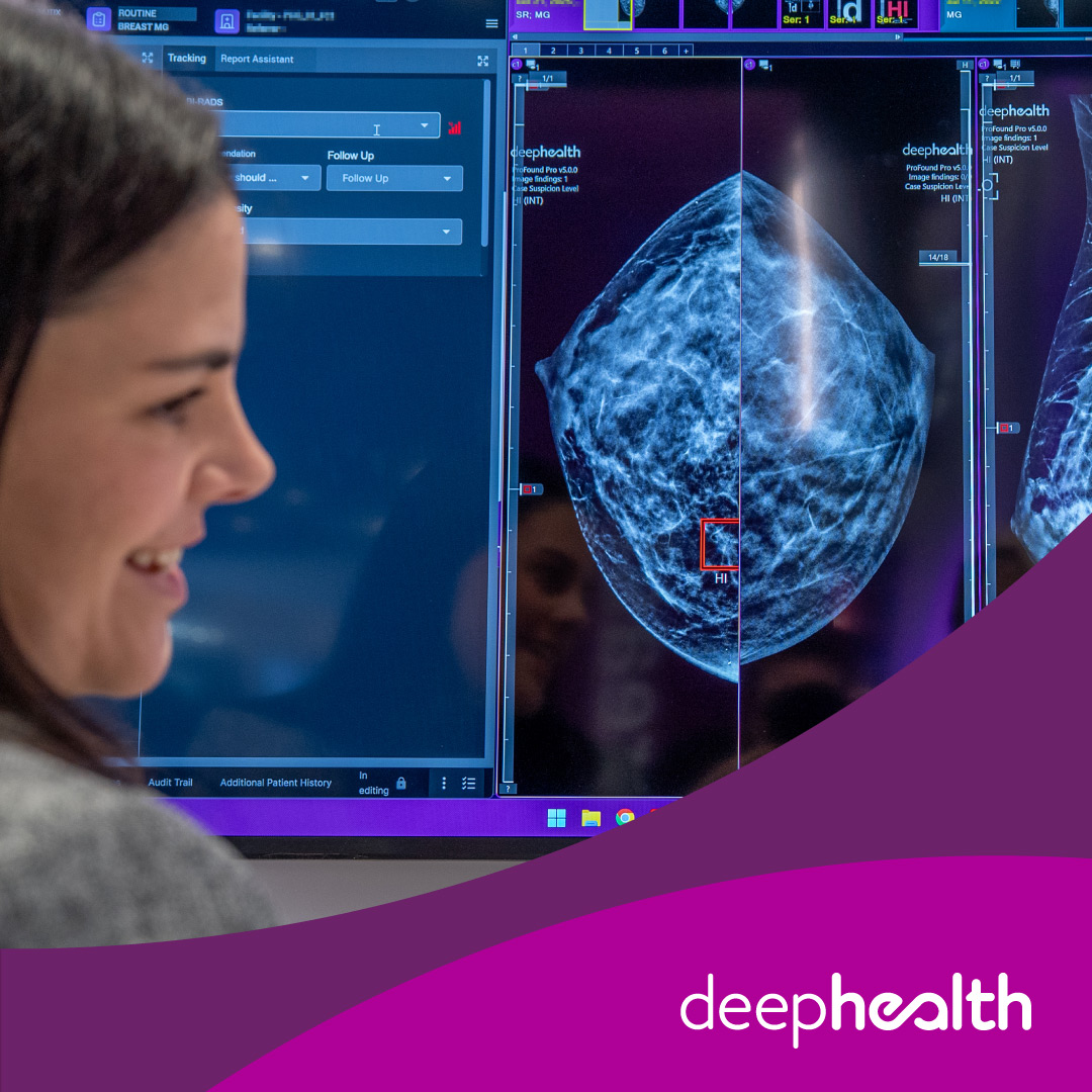 Study Shows AI Can Bring Specialist-Level Breast Cancer Detection to More Patients