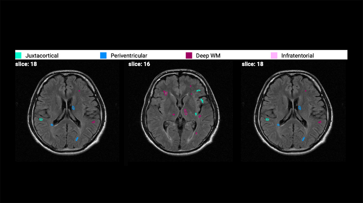 Brain Health
