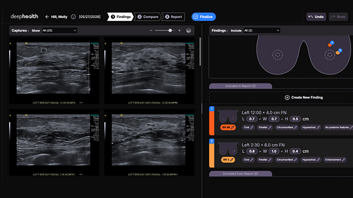 Breast Ultrasound