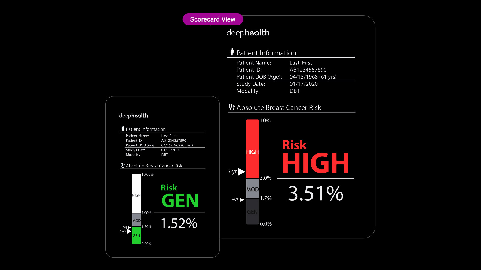 Mammo Risk