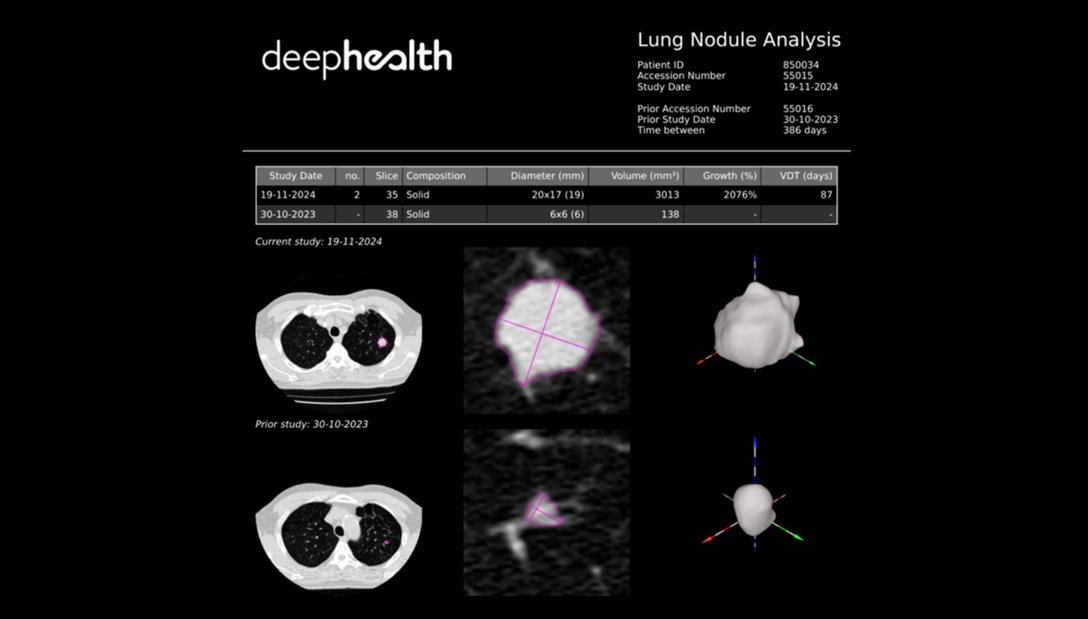 Chest Suite Features