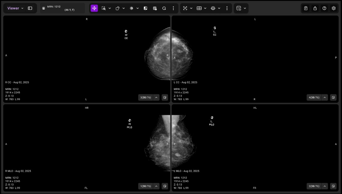 Ultra-fast image access