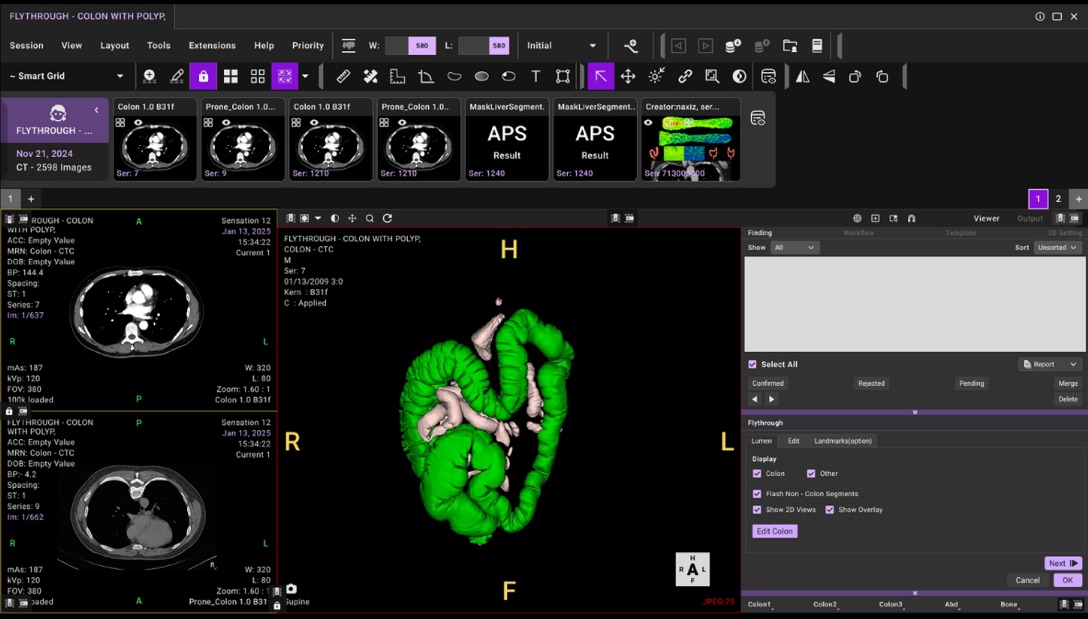 Integrated Advanced Visualization