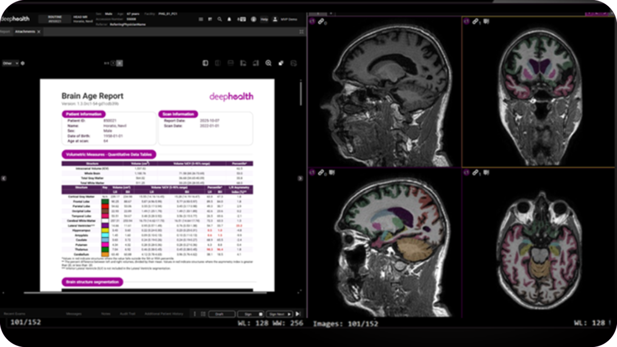 What if the earliest signs of neurodegenerative disease could be identified before symptoms emerge? 